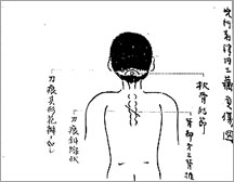 (9) 兇行者津田三蔵負傷図